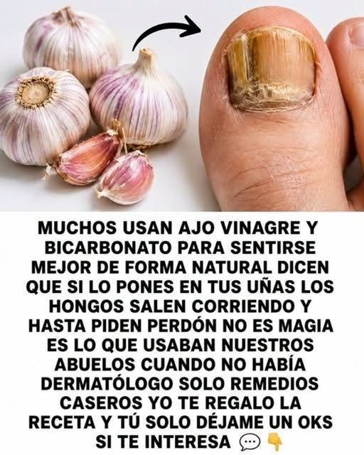 Remedio natural para hongos en los pies