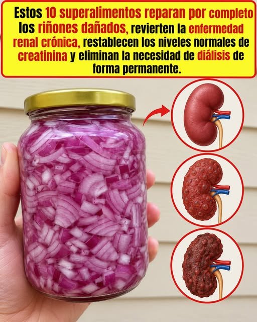 Cebolla Roja