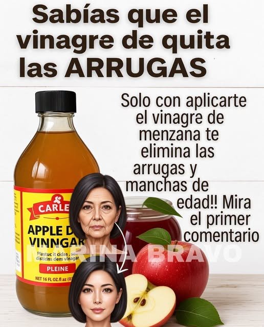 Beneficios del vinagre de manzana en la piel