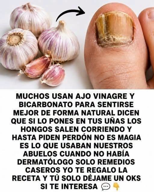 Ajo y vinagre contra hongos