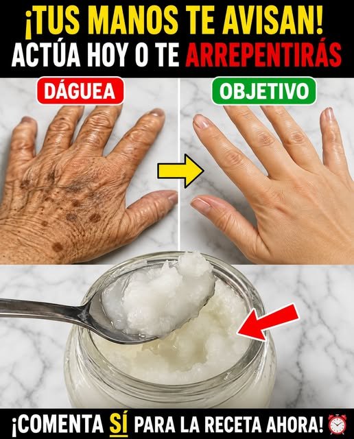 Transformación de manos con remedios caseros