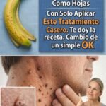 Remedios Naturales para Eliminar Verrugas Fibromas Manchas y Espinillas