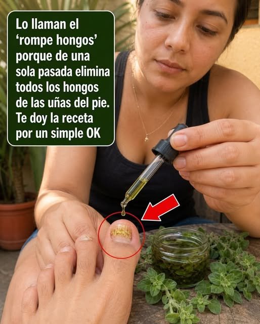 Tratamiento de hongos en las uñas