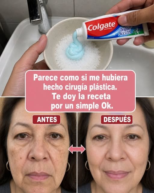 Remedios Caseros para Mejora de Piel