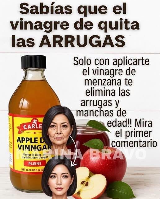 Vinagre de manzana como remedio natural