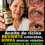 Aceite de Ricino y Salud Ocular Un Enfoque Natural para Mejorar tu Visión