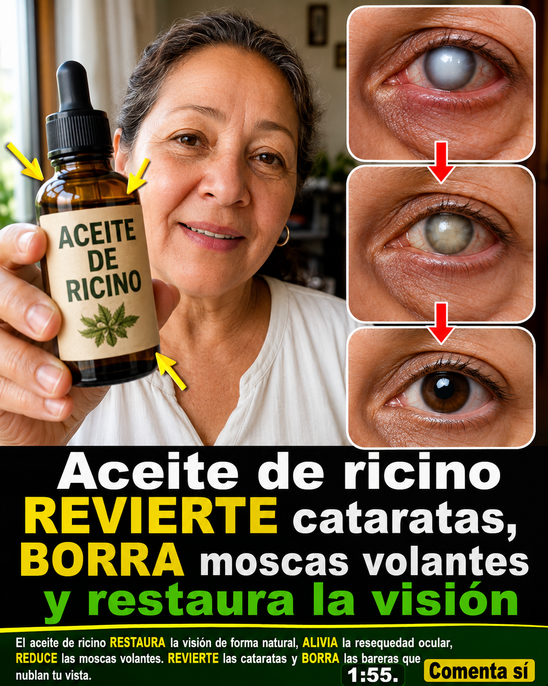 Aceite de Ricino