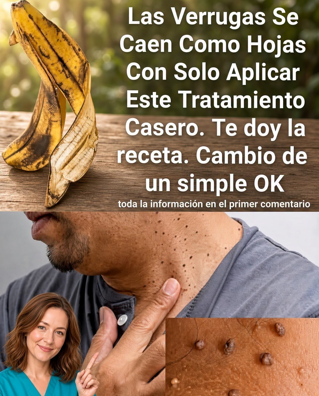 Remedios caseros para verrugas
