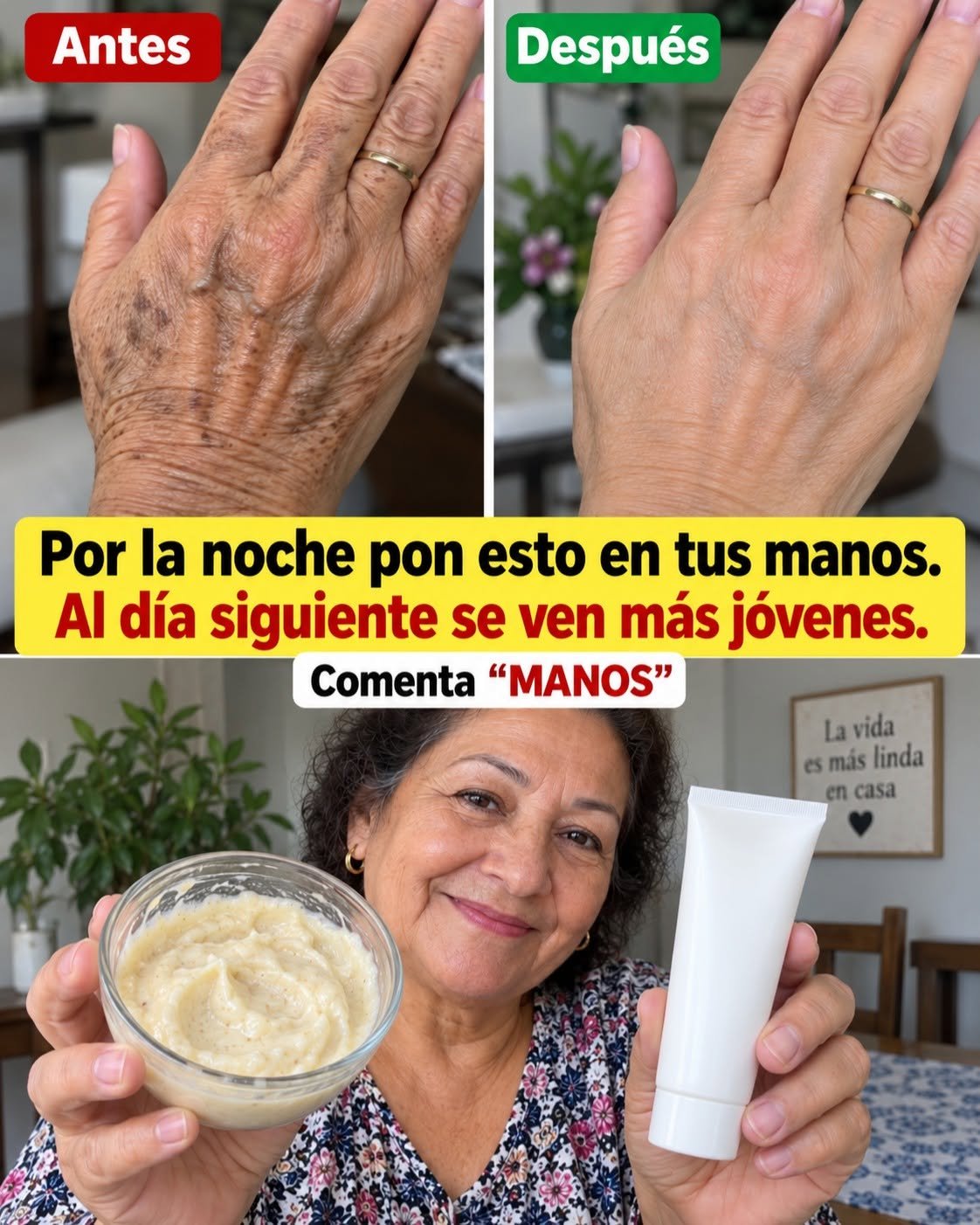 Antes y Después del tratamiento para manos
