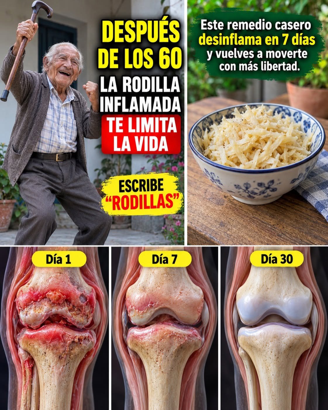 Remedios caseros para la inflamación de rodillas en mayores