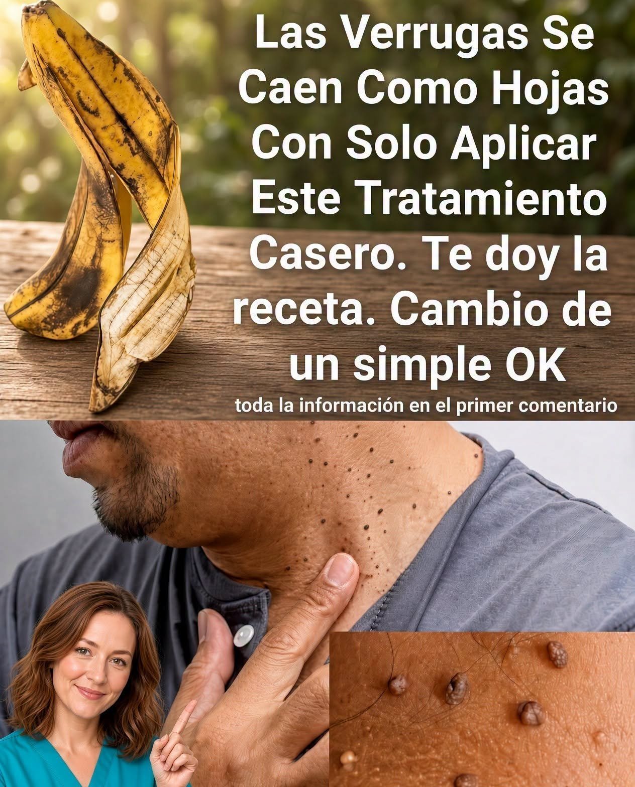 Remedios caseros para verrugas