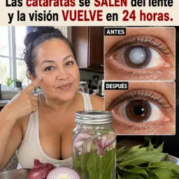 Cuidado de ojos y cataratas