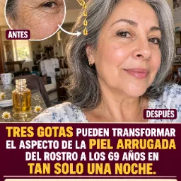 Aceite de Jojoba